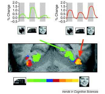 01-eScience/fMRI1.png