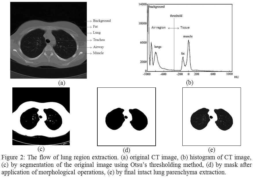 21-BioImage/otsu_lung.jpg